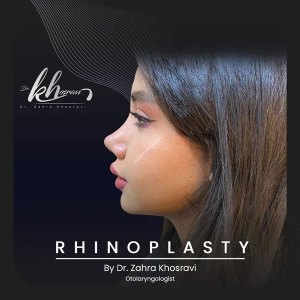 جراحی-بینی-1