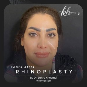 جراحی-بینی-10