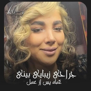 جراحی-بینی-11
