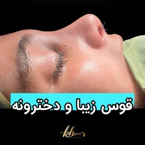 rhinoplasty-53