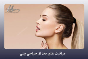 مراقبت های بعد از جراحی بینی - دکتر زهرا خسروی در شیراز