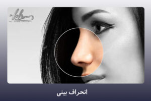 انحراف بینی - دکتر زهرا خسروی در شیراز