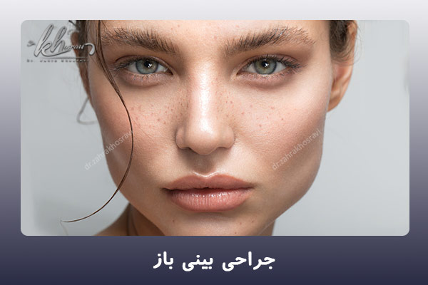 جراحی بینی باز - دکتر زهرا خسروی در شیراز
