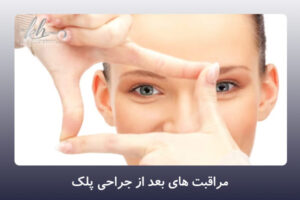 مراقبت های بعد از جراحی پلک - دکتر زهرا خسروی در شیراز