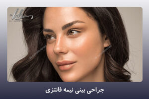 جراحی بینی نیمه فانتزی در شیراز - دکتر زهرا خسروی