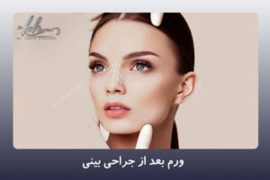 ورم بعد از جراحی بینی - دکتر زهرا خسروی