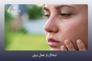 تبخال و عمل بینی - دکتر زهرا خسروی - https://drzahrakhosravi.com/