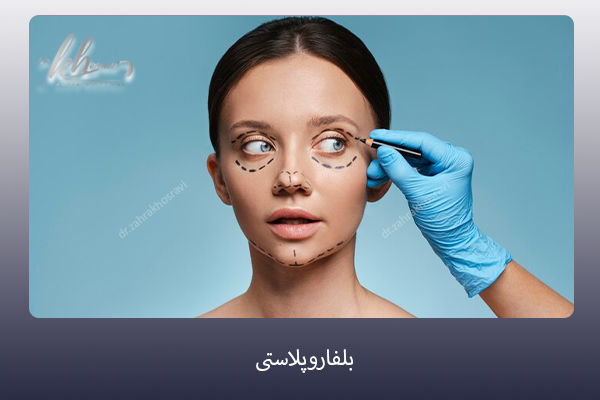 بلفاروپلاستی - دکتر زهرا خسروی https://drzahrakhosravi.com/