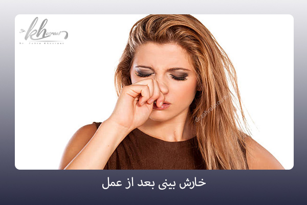 خارش بعد از جراحی بینی - دکتر زهرا خسروی - https://drzahrakhosravi.com/