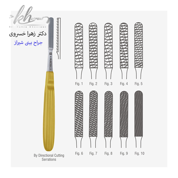 سوهان کشی بینی - دکتر زهرا خسروی - https://drzahrakhosravi.com/