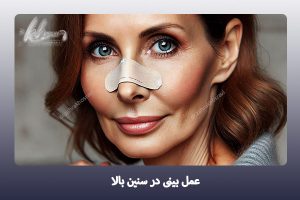 جراحی بینی در سنین بالا - دکتر زهرا خسروی