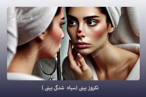 نکروز بینی - دکتر زهرا خسروی