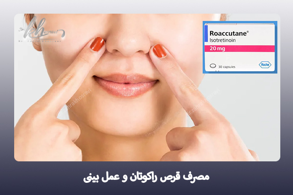 مصرف راکوتان بعد از عمل بینی- دکتر زهرا خسروی