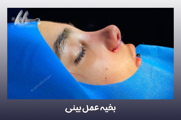 بخیه‌ عمل بینی - دکتر زهرا خسروی