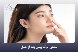 سفتی نوک بینی بعد از عمل