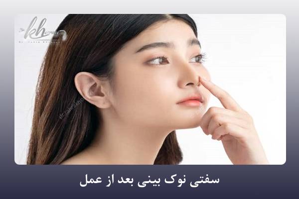 سفتی نوک بینی بعد از عمل