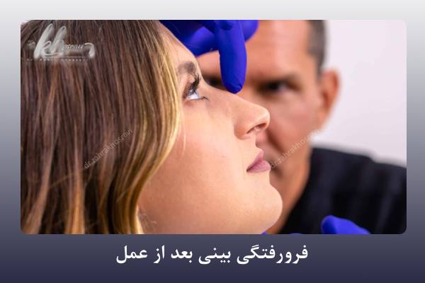 فرورفتگی بینی بعد از عمل