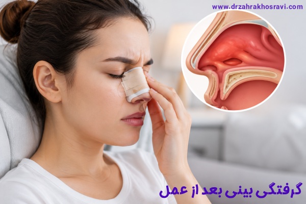 گرفتگی بینی بعد از عمل